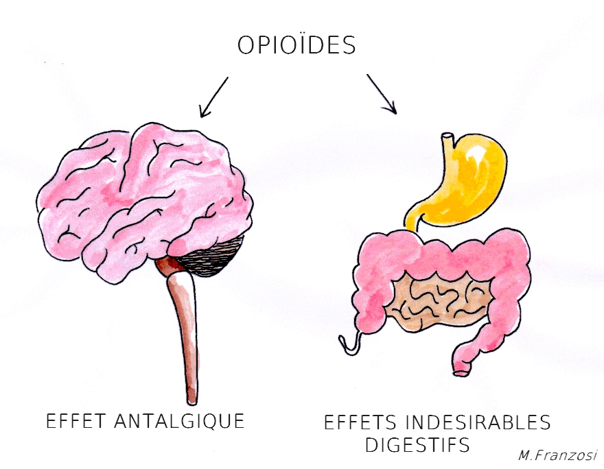 La constipation due aux opioïdes – Atelier@ntalgiques