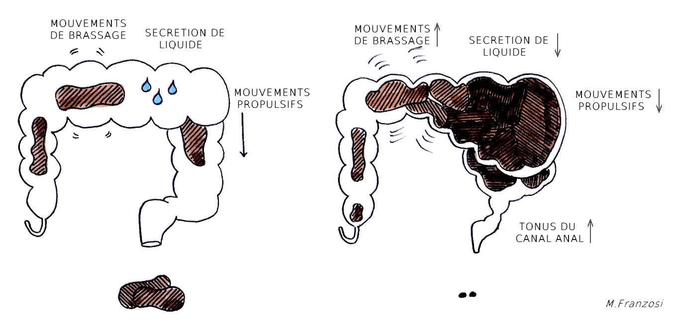 La constipation due aux opioïdes – Atelier@ntalgiques